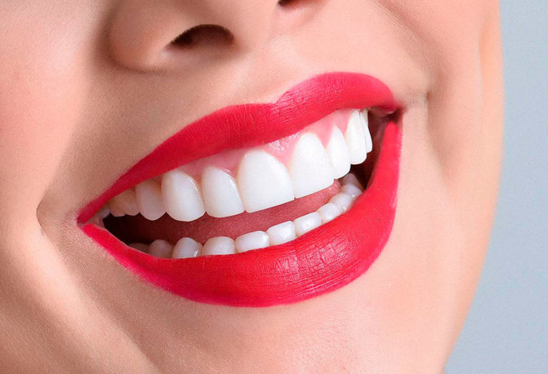 Tres métodos para conseguir una resplandeciente sonrisa colgate