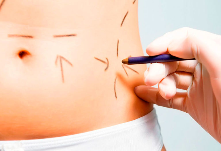 ¿Problemas con la obesidad y el sobrepeso? Esta es la solución